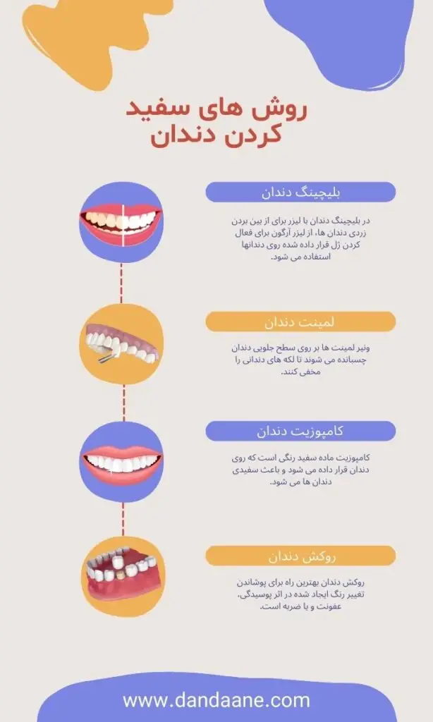 روش های سفید کردن دندان