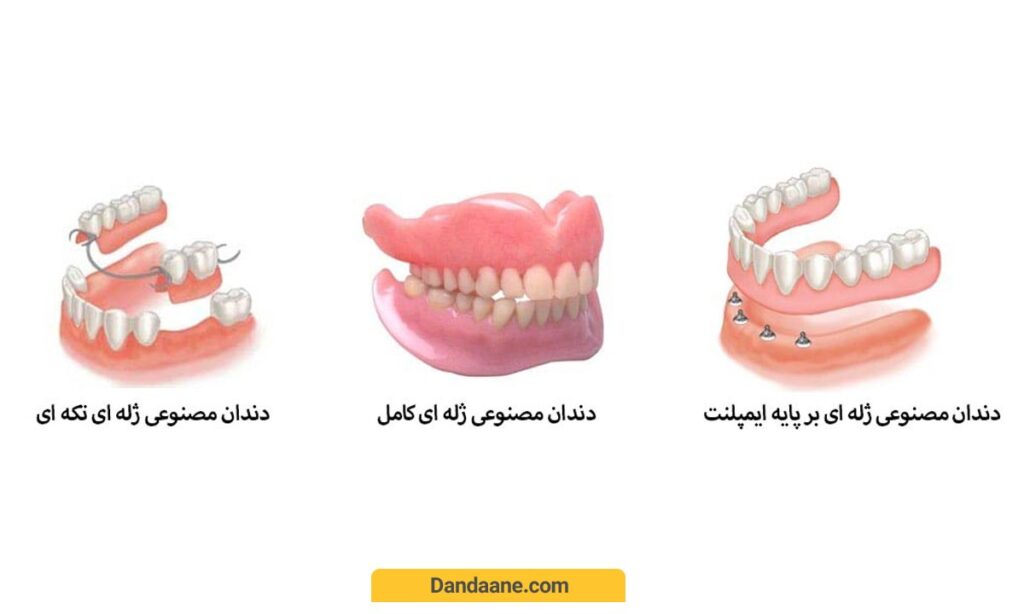 تصاویر انواع دندان مصنوعی ژله ای 