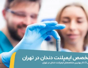 متخصص ایمپلنت دندان در تهران