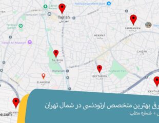 بهترین متخصص ارتودنسی در شمال تهران