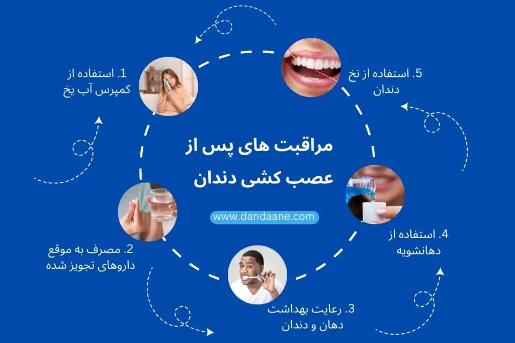 مراقبت های پس از عصب کشی دندان 